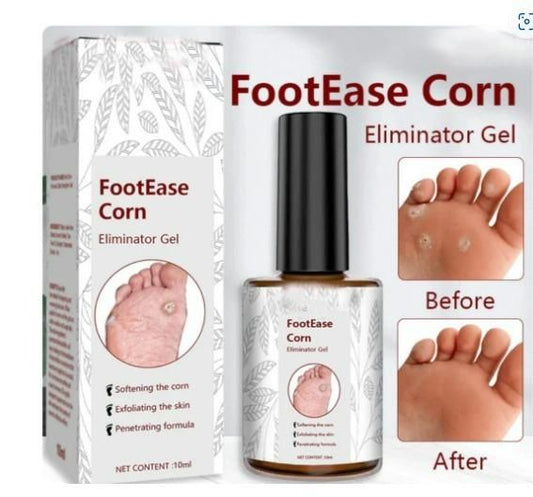 Feet Corn Removal Serum 30ml ( Pack Of 1 )